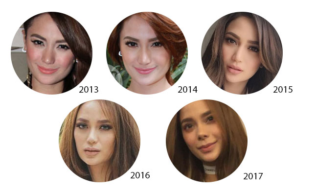 A Cosmetic Surgeon Gives The Lowdown On Arci Munoz's Transformation ...