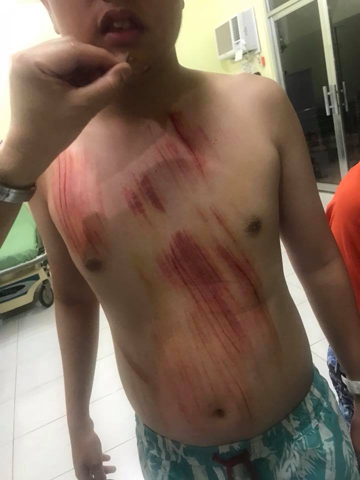 Karen Davila's son involved in surfing accident in Siargao ...