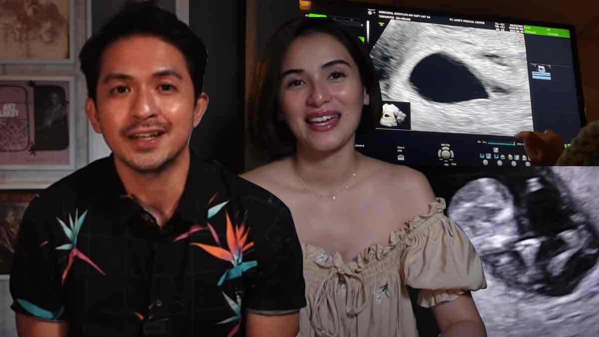 Jennylyn Mercado and Dennis Trillo detail their pregnancy journey