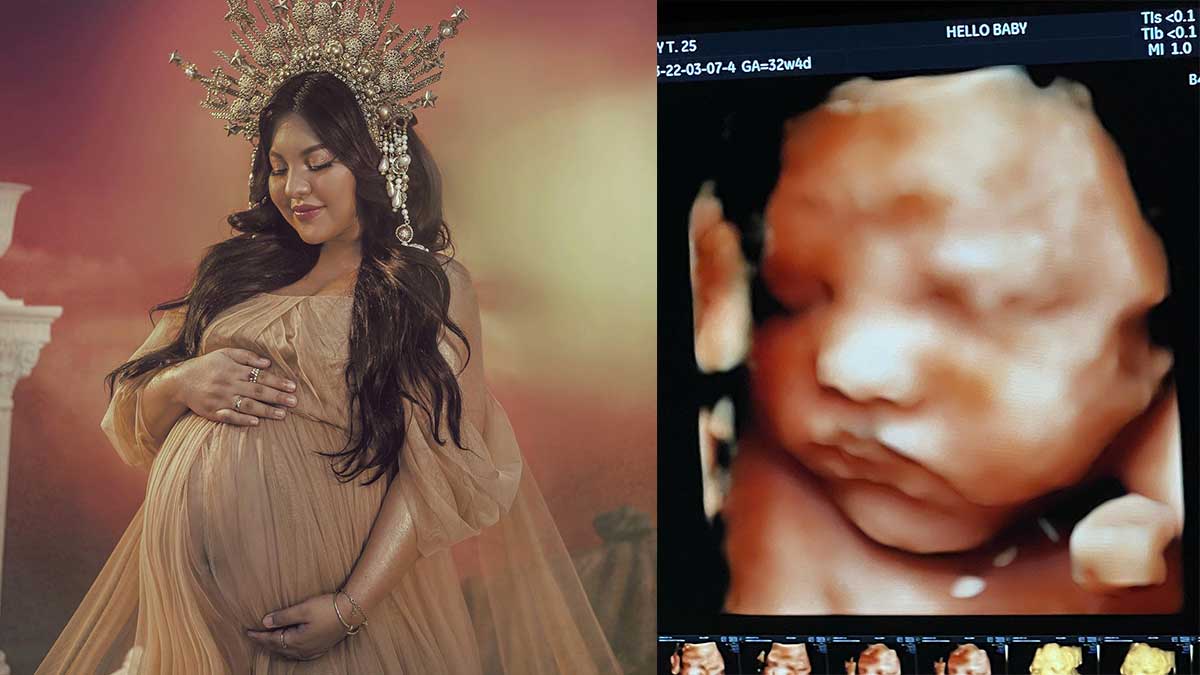 Viy Cortez, Cong TV, pregnancy, Baby Kidlat