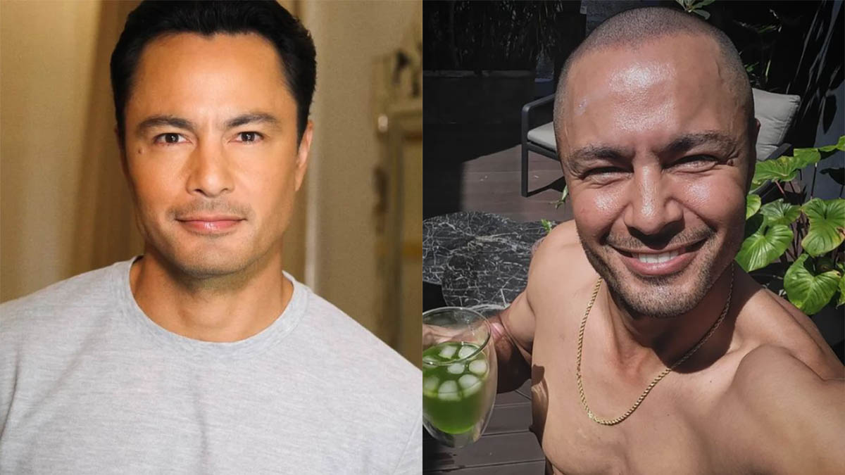 derek ramsay with hair and bald