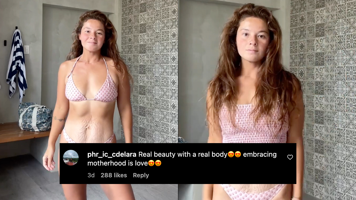 Netizens commend Andi Eigenmann for normalizing stretch marks