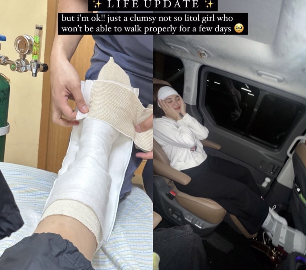 Janella Salvador ankle injury