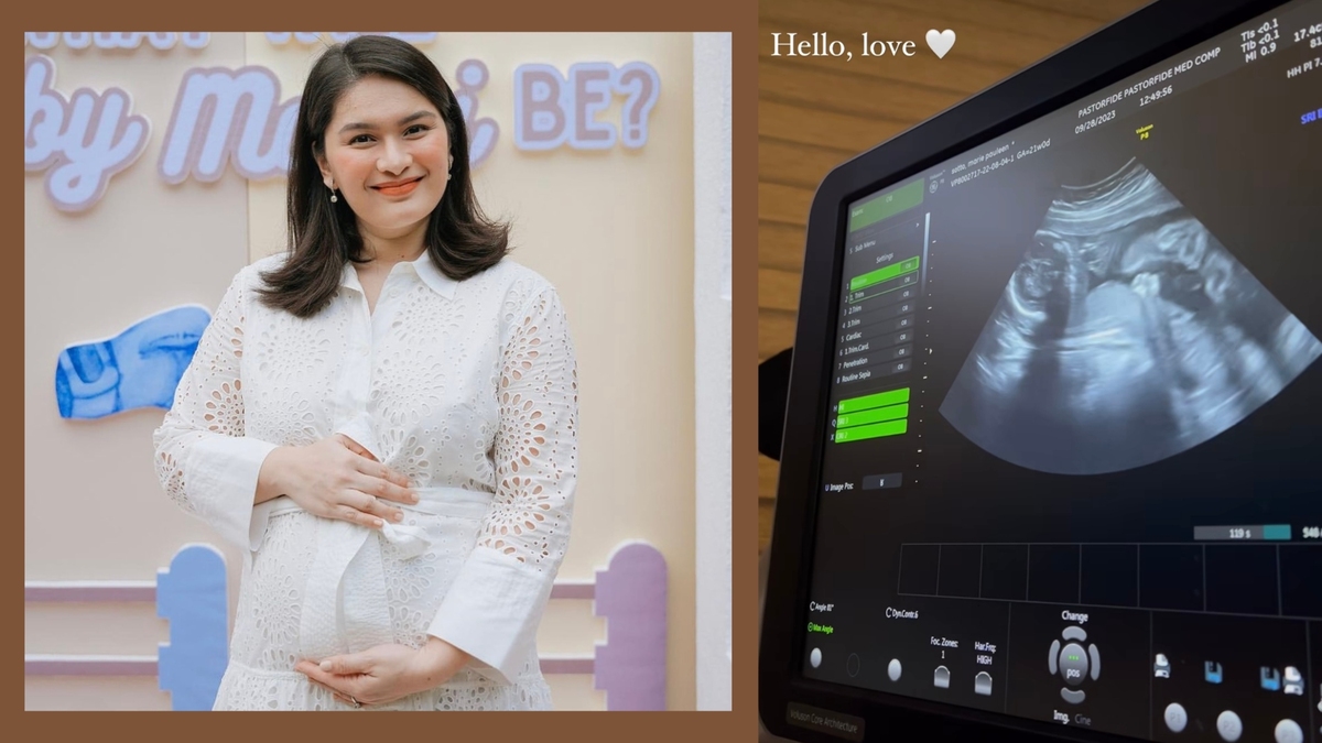 Pauleen Luna shares sonogram of baby no. 2: "Hello, love"