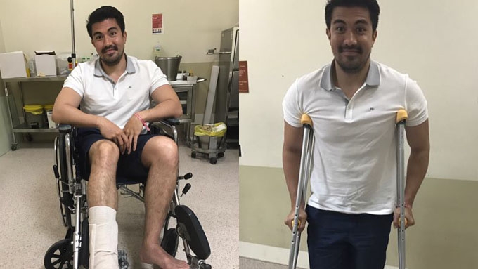 Luis ManzanoÂ suffers foot fracture; might undergo surgery | PEP.ph