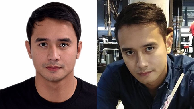 Jm De Guzman Bald Online | emergencydentistry.com