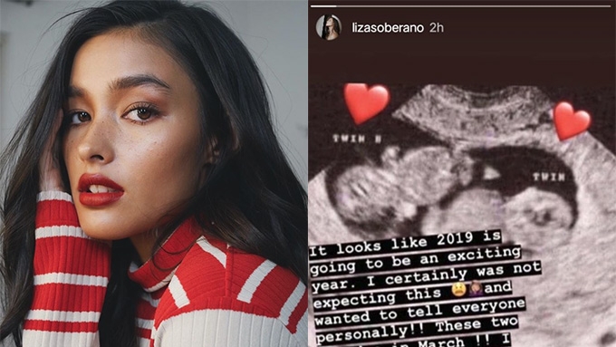 Liza Soberano fans freak out over ultrasound photo; ask, "Is she pregnant?"  | PEP.ph